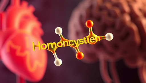 Elevated Homocysteine 17.46: What You Need to Know